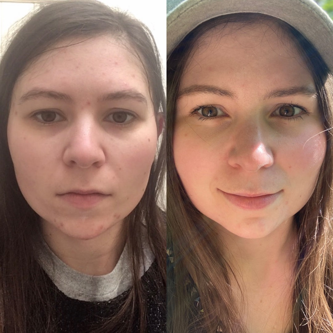 Before and After photo of Tiffany S.