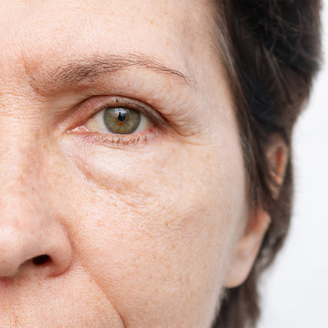 woman with slightly puffy eyes